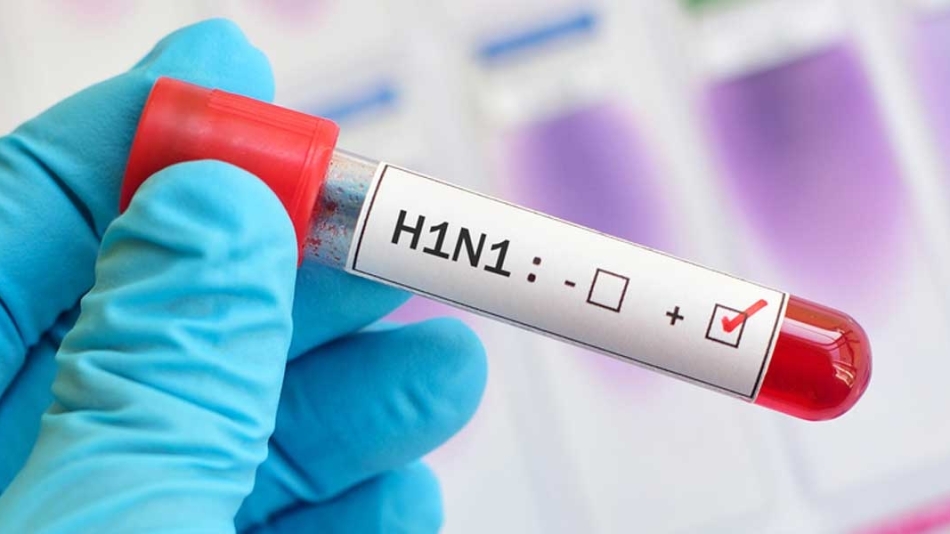 Domuz Gribi, A (H1N1) Bilgilendirme Broşürü