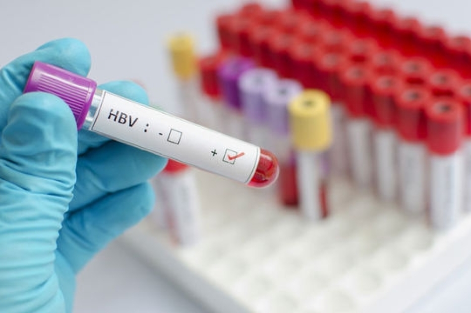 Berber ve Kuaförlere Hepatit Taraması